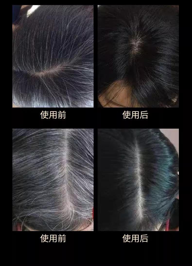 【中国直邮】 南京同仁堂 黑灵芝人参何首乌洗发皂  白发转黑 防脱育发 滋养毛囊 顺滑秀发100g/盒