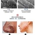 Sulfur Cleansing Facial Cleanser can remove mites shrink pores blackheads and acne and control oil. 100g