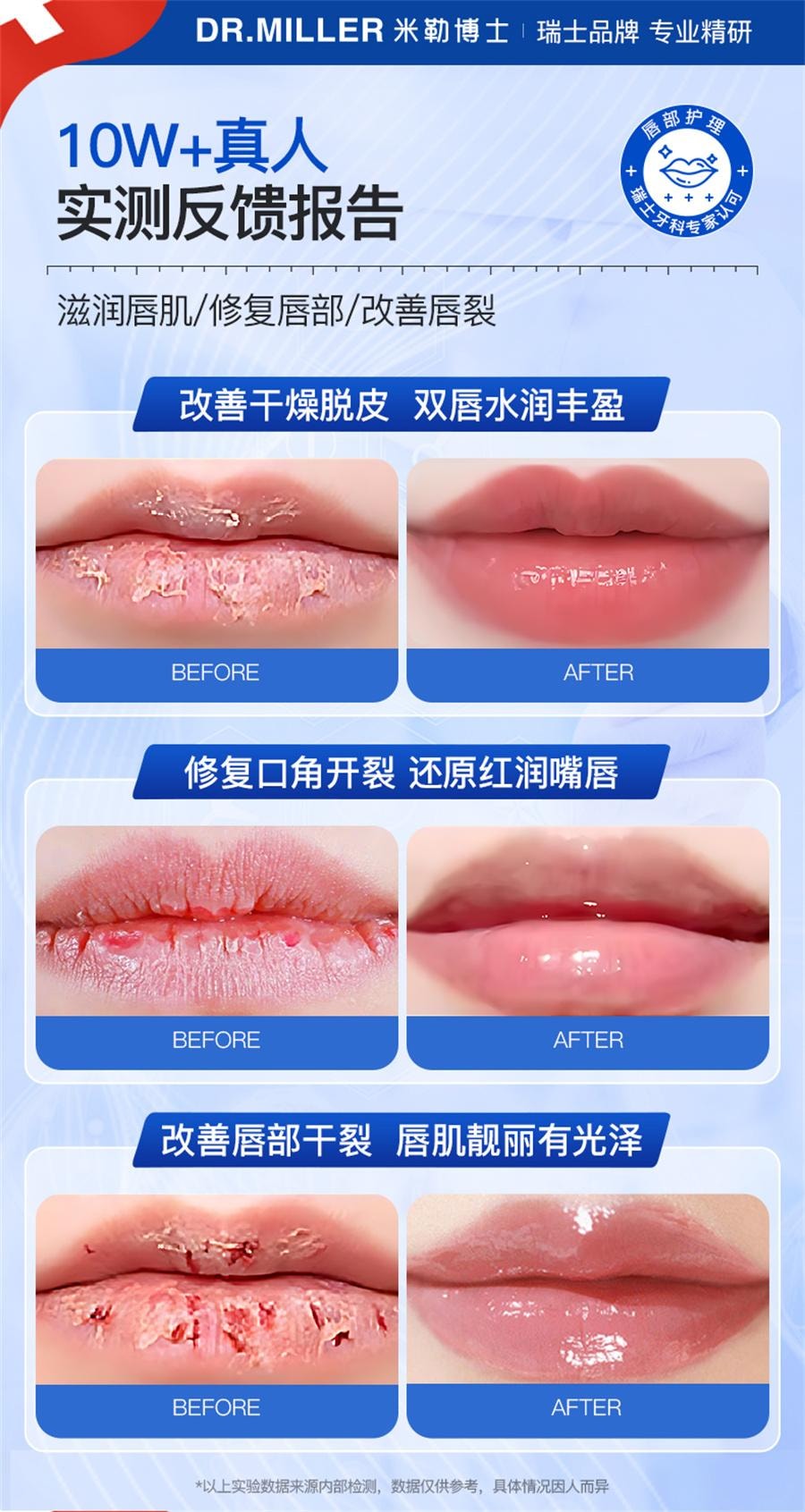 【中国直邮】DR MILLER/米勒博士  唇炎润唇膏嘴唇干裂脱皮专用保湿滋润去死皮口角炎疱疹医用修护膏  15g/支