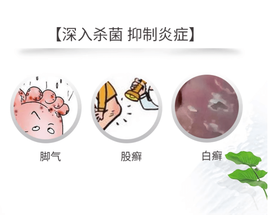 【日本直郵】小林製藥腳氣液腳臭股癬香港腳止癢消炎除菌30ml