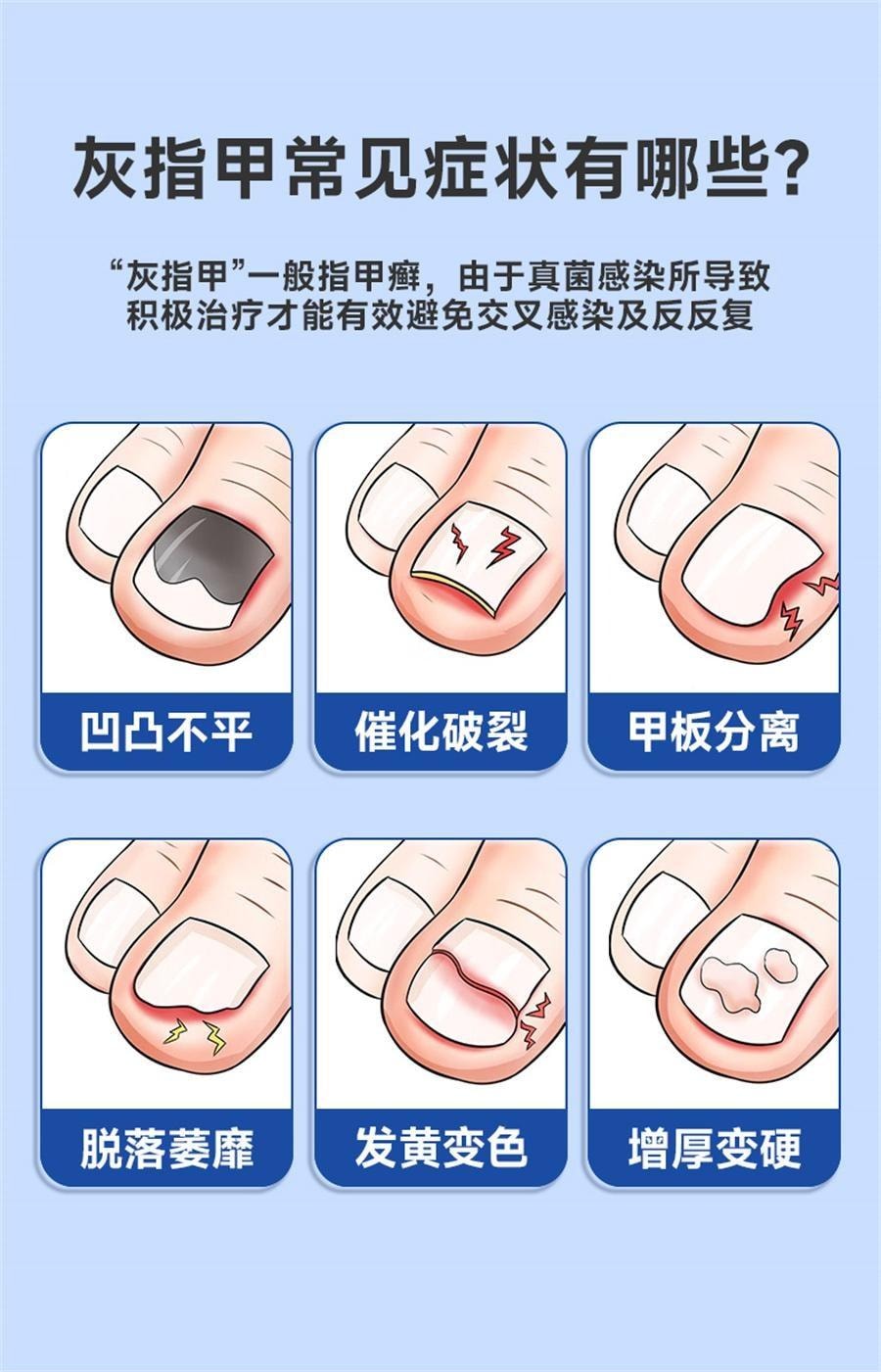 【中国直邮】 恒医森 环吡酮胺乳膏 治疗灰指甲专用药环比癣症真菌脚气止痒脱皮杀菌药水 20g/支