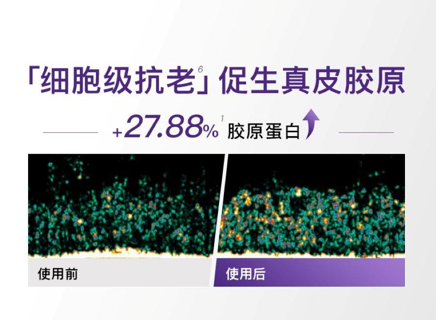 【日本直邮】 日本 雅萌 最新款 Max三代 赫兹射频美容仪SP Ⅲ M25 1台