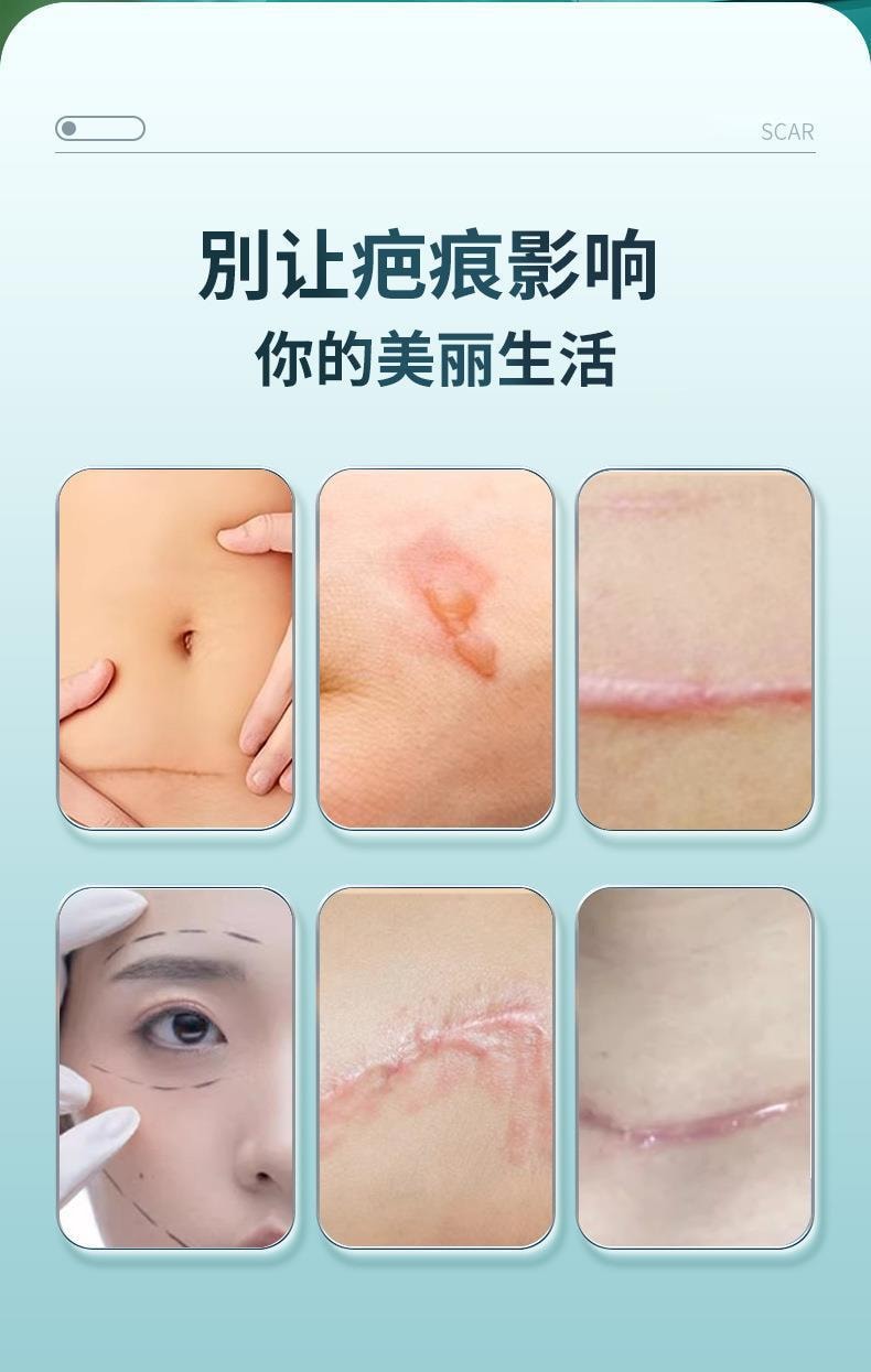 【中國直郵】葵花藥業 醫用疤痕貼 疤痕增生貼 剖腹產術後增生 去除疤貼 修復外用祛疤貼 3貼/盒