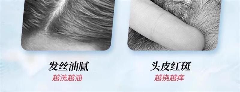 【中国直邮】 999 二硫化硒洗剂去屑洗头水控油洗发液止痒洗发水露 200ml