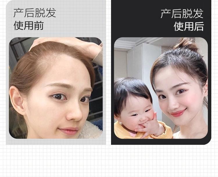 【中国直邮】 修正 防脱育发洗发液生姜侧柏叶生增发密发固发苗坚洗发水控油蓬松 防脱育发洗发水300ml