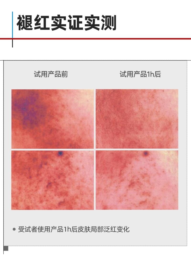 芙清 FulQun 修红祛痘次抛精华液 1.5ml*30支