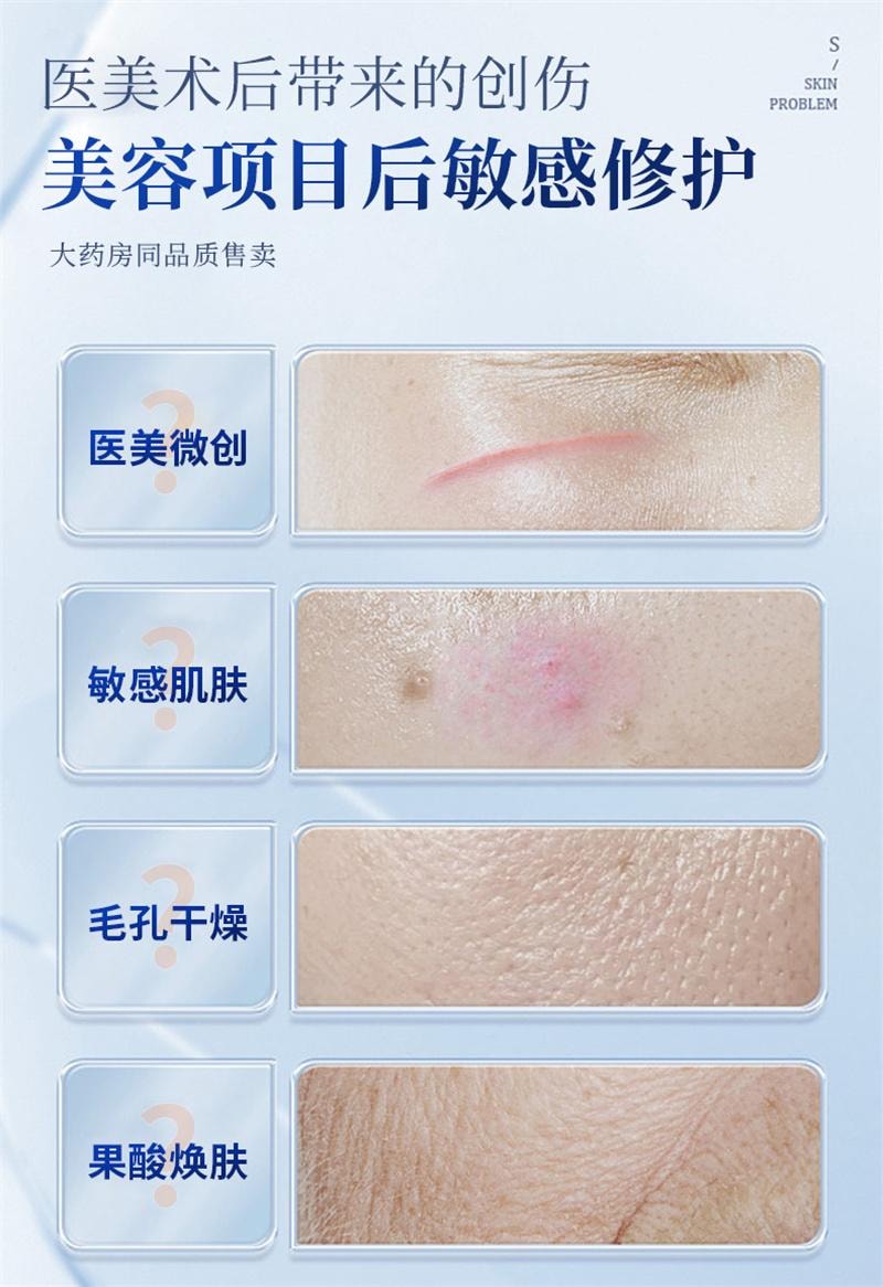 【中国直邮】 舒奈美 重组III型胶创面修护敷料医用原蛋白敷料院线美容术后面膜  4片/盒