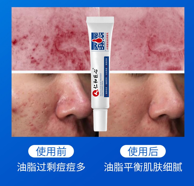 【中国直邮】仁和 水杨酸祛痘调理乳淡化痘肌痘印温和去痘痘30g (买二送一)