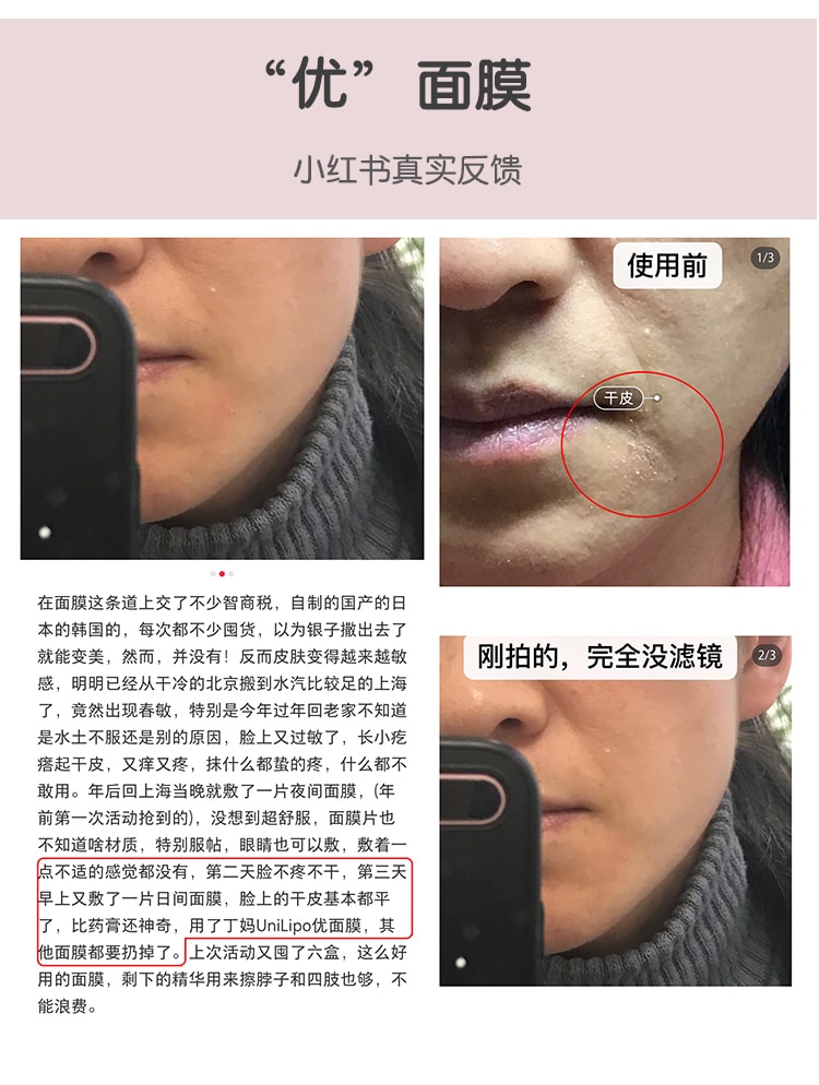 【中国直邮】UniLipo脂质体生物纤维面膜  修护 4片