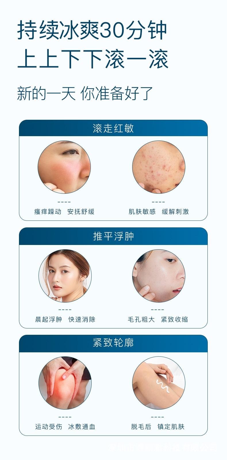 SOICY 【水腫臉救星 消腫神器】冰滾輪 臉部冷敷按摩儀 物理消腫 去腫眼泡 冰鎮舒緩 緊膚塑顏 1支裝