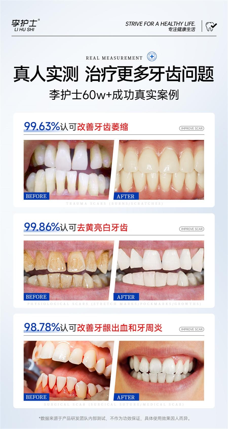 【中国直邮】 李护士 牙龈萎缩修复再生专用非牙膏治牙周炎口腔护理脱敏  120g/支
