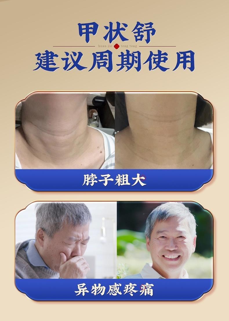 【中國直郵】 北京同仁堂 甲狀腺結節消散結貼專用消除甲亢脖子粗4a冷敷凝膠膏 10貼/盒