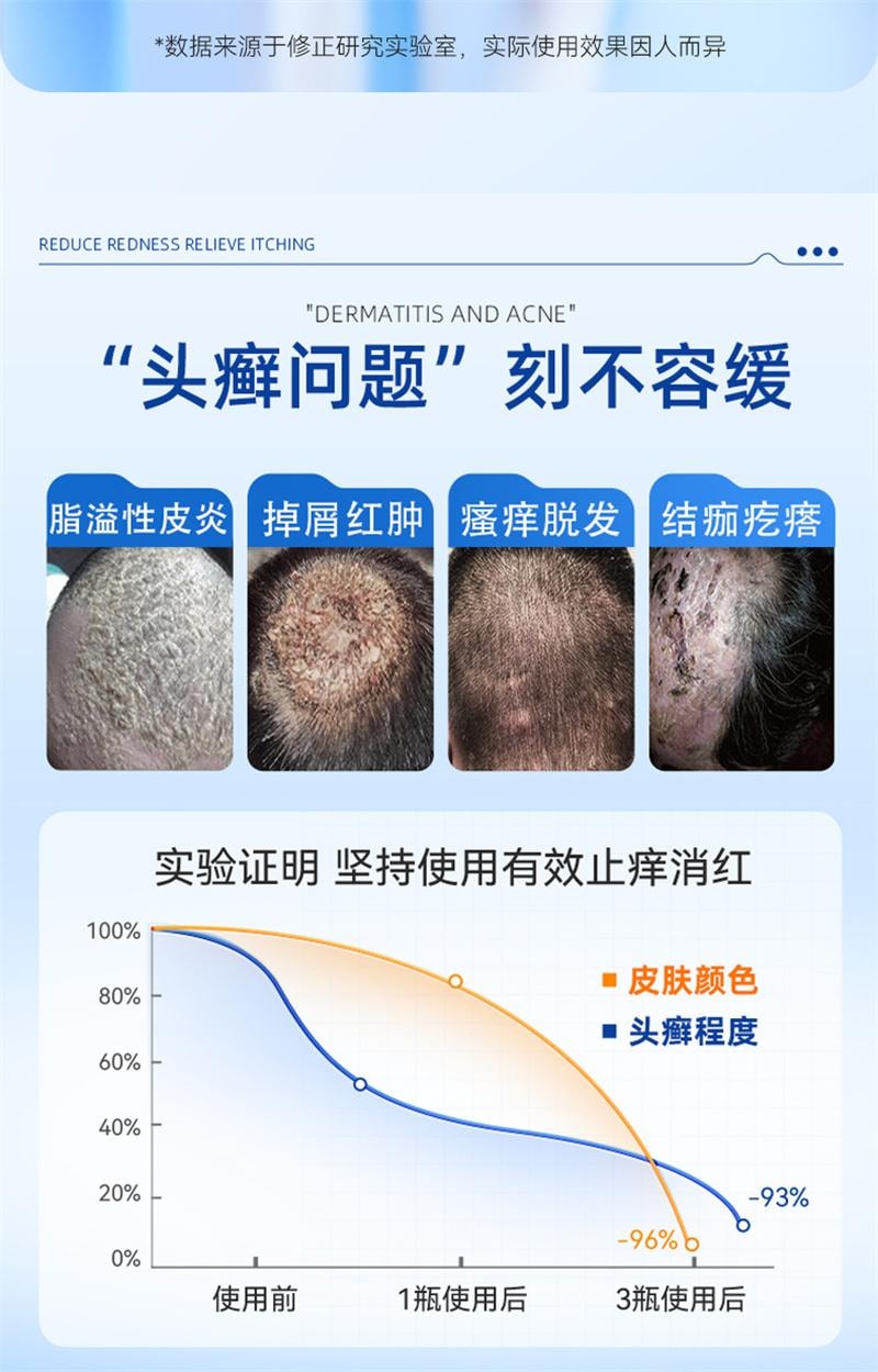 修正 美国  头皮屑脂溢性皮炎真菌感染非药膏治头部银屑癣皮肤痒毛囊炎特效药卡波姆皮肤湿性敷料 20ml