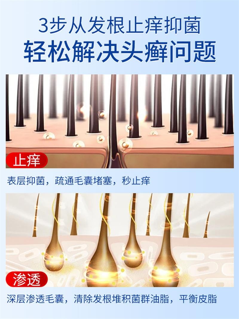 修正 美国  头皮屑脂溢性皮炎真菌感染非药膏治头部银屑癣皮肤痒毛囊炎特效药卡波姆皮肤湿性敷料 20ml