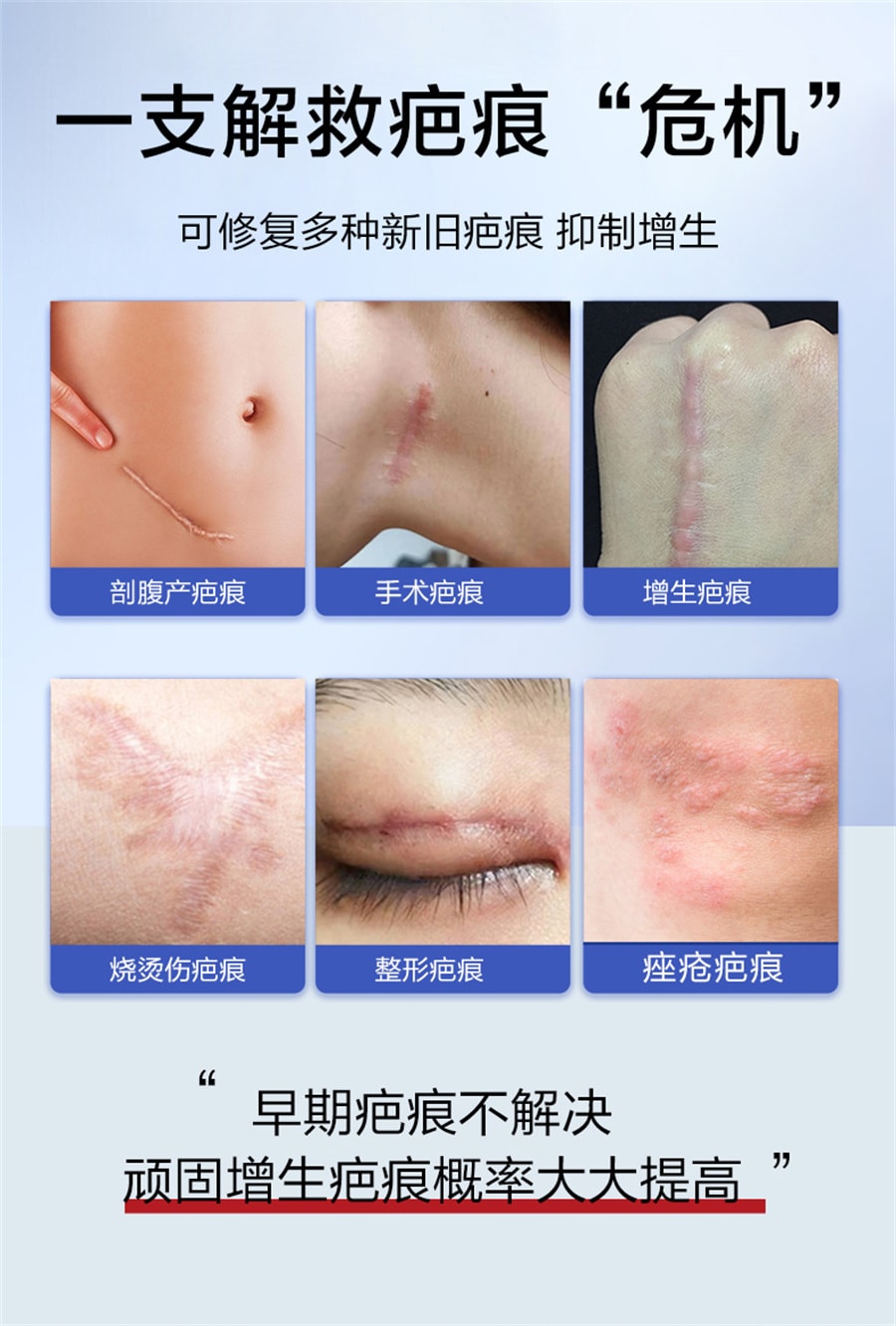 【中国直邮】可孚  医用祛疤膏硅酮凝胶去疤痕修复除疤剖腹产手术增生儿童去疤膏    20g/支