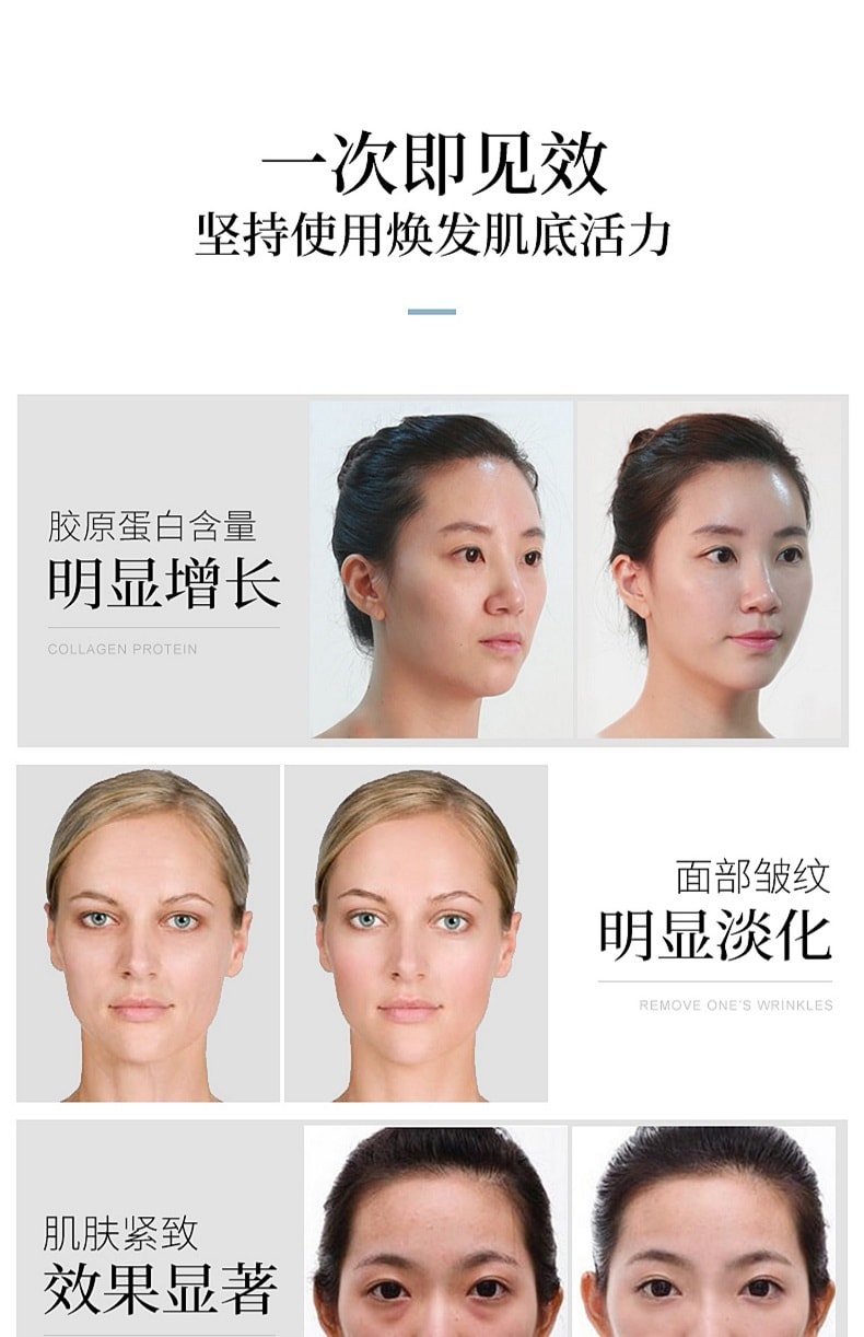 【中國直郵】卡蕾蘭 RF射頻美容家用臉部導入儀器臉部潔面光子嫩膚提拉緊致童顏機去法令紋神器 紫色