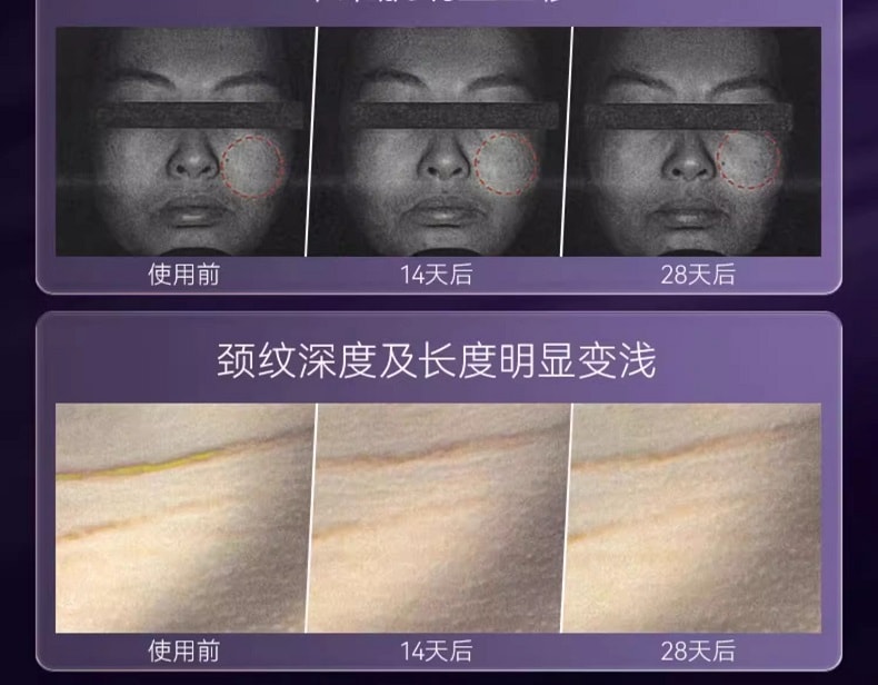 【新品上市】VZUSA II 美杜莎二代美容儀器 臉部按摩微電流導出導入儀 綾紫色 [美國發貨3-5天簽收]