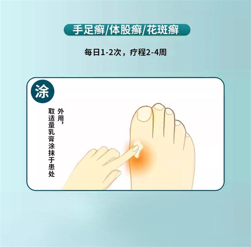  仁和 环吡酮胺乳膏10g灰指甲治疗专用药膏水正品真菌感染脚气药