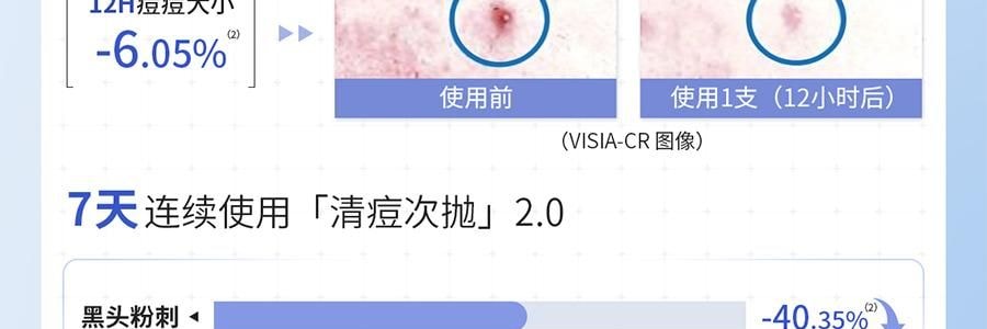 VOOLGA敷尔佳 清痘净肤次抛精华 2.0 1.5ml*30支 速效祛痘淡印 控油舒缓 油痘敏感肌适用