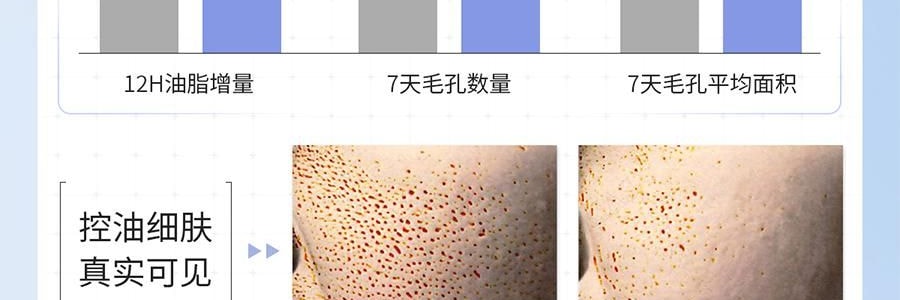 VOOLGA敷尔佳 清痘净肤次抛精华 2.0 1.5ml*30支 速效祛痘淡印 控油舒缓 油痘敏感肌适用