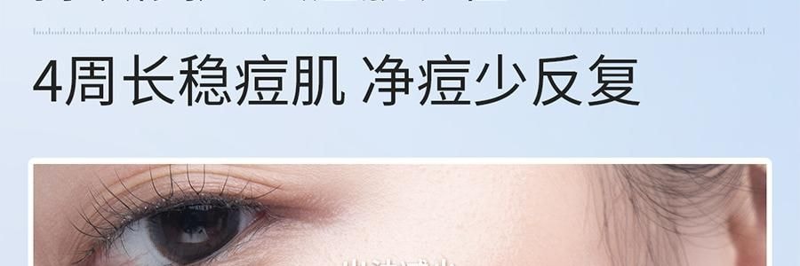 VOOLGA敷尔佳 清痘净肤次抛精华 2.0 1.5ml*30支 速效祛痘淡印 控油舒缓 油痘敏感肌适用