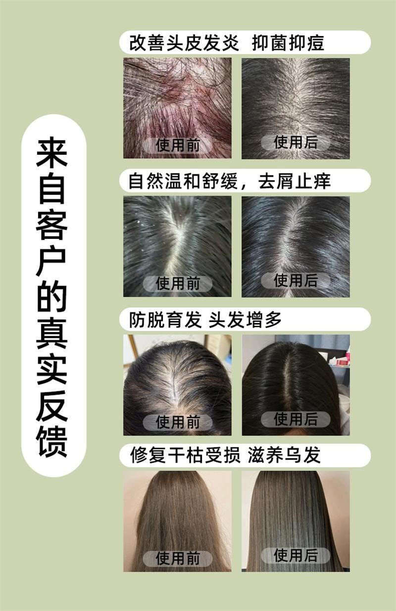 【中国直邮】 潮利 侧柏叶洗发水 去屑止痒控油生姜防脱生发纯草本洗发水500ml/瓶