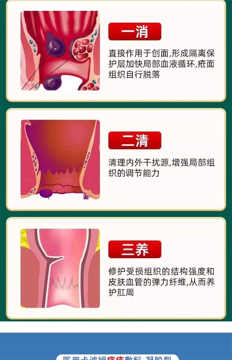 美国 仁和 消痔凝胶 痔疮膏内外痣疮舒肉肛球周瘙痒舒痔型卡波姆敷料  5支/盒