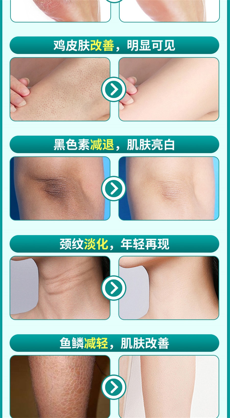 【中國直郵】 硬核醫師 尿素維E乳膏 維e乳軟膏外塗去黑色素尿酸尿囊素護手霜50g/支