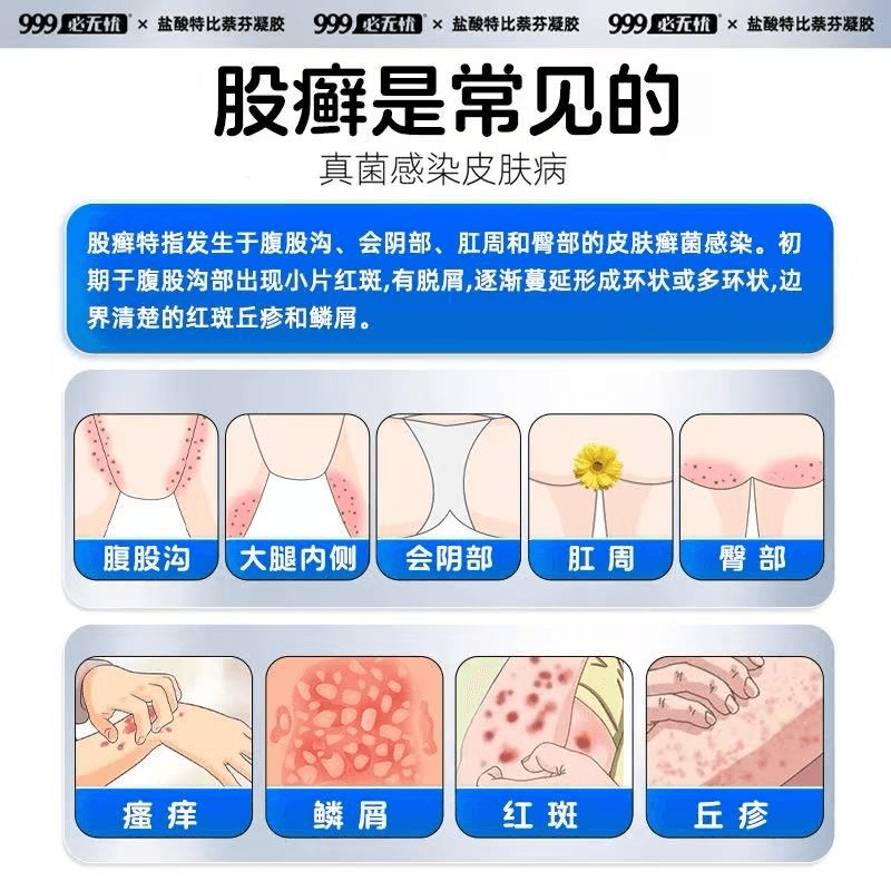 999 必无忧凝胶软膏20g 股癣脚气 止痒脱皮烂脚丫