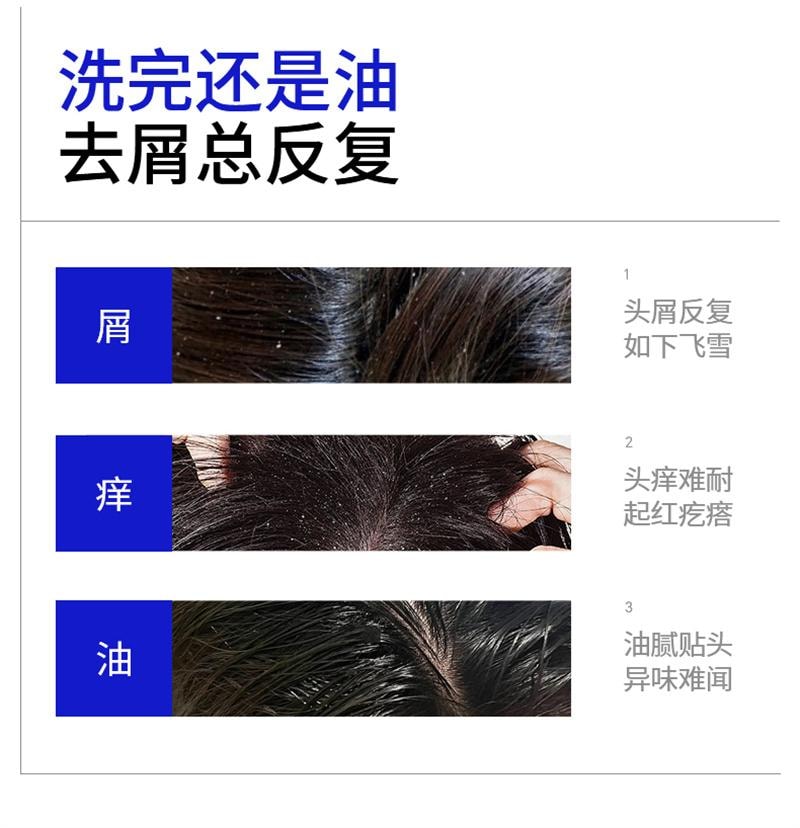 【中国直邮】 EHD 二硫化硒控油去屑洗发水 毛囊清洁蓬松洗头露膏男女 400ml