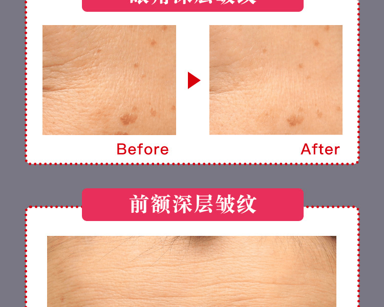 ASTALIFT 艾诗缇||THE SERUM臻粹精华眼部日用抗皱棒||5g