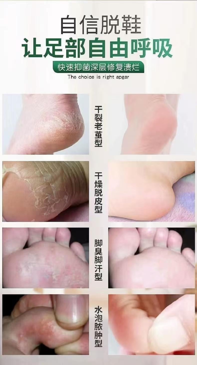 Foot Odor And Sweat Spray 50 ml