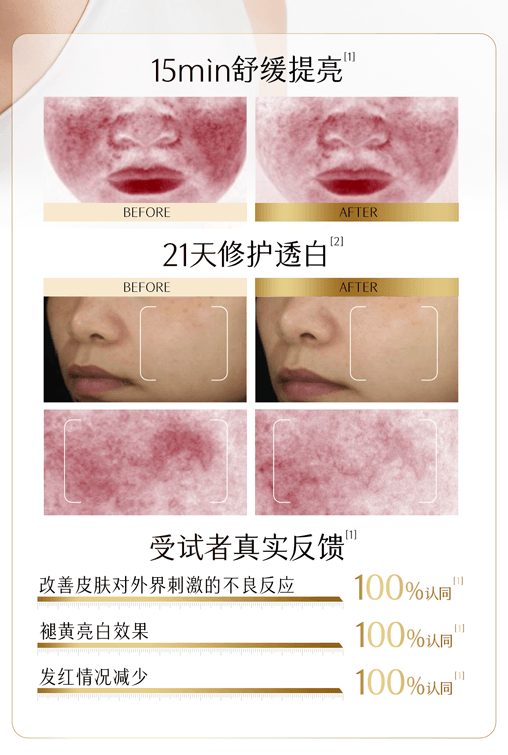 谷雨 【买2送1-美白3个月量】美白次抛精华液【长效透白】【美白特证】【21天焕现白皙】补水保湿 美白淡斑 舒缓 1.5ml*30 / 盒(共三盒)