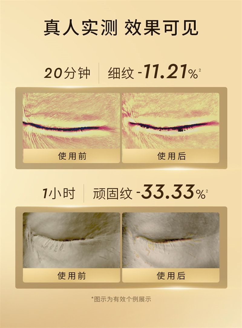 【中國直郵】澳洲 cemoy. 第3代小飛碟 晶耀立體緊緻多效眼霜 撫眼紋 提眼角 淡淚溝 塑眼廓 20ml/瓶【朱梓驍同款】