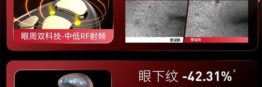 JMOON極萌 大熨斗射頻家用美容儀 臉部提拉緊緻V臉紋 附贈2支80g凝膠【海外版真射頻 滿血功能】