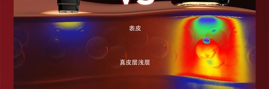 JMOON極萌 大熨斗射頻家用美容儀 臉部提拉緊緻V臉紋 附贈2支80g凝膠【海外版真射頻 滿血功能】