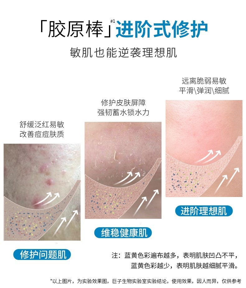 [中国直邮]可复美Comfy 胶原棒human-like重组胶原蛋白肌御修护次抛精 1.5ml 30支1盒