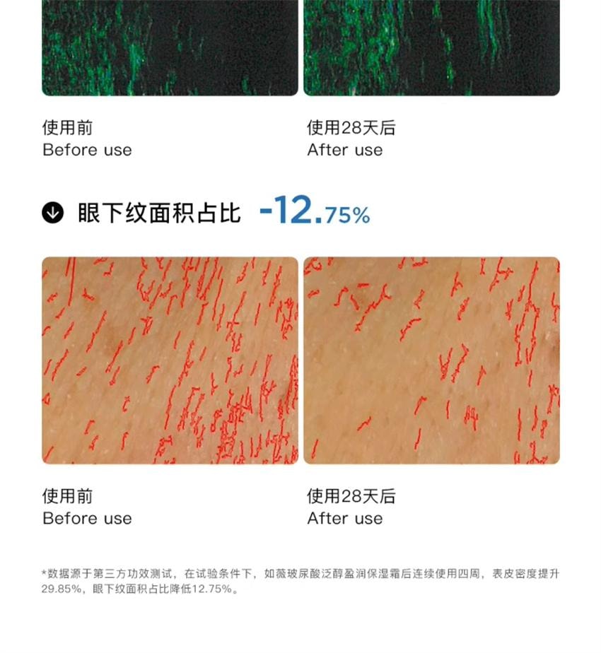 【中國直郵】韓國 RNW 如薇 透明質酸泛醇盈潤保濕霜 補水保濕深層滋潤改善乾皮肌膚潤膚 50g/瓶(K總推薦)
