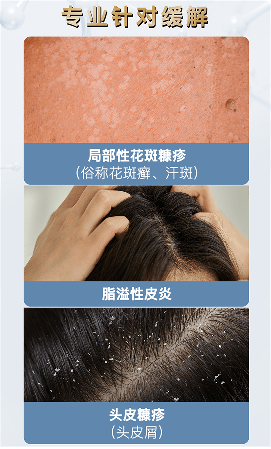 【中國直郵】 採樂 脂漏性皮膚炎頭部洗髮精酮康唑洗劑去屑止癢醫用毛囊炎頭皮癢 2%*50ml/瓶