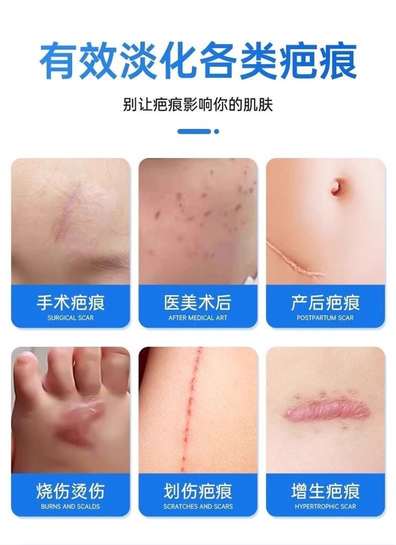 【中国直邮】 法兰度 医用硅酮疤痕凝胶15g修复祛疤膏去疤淡疤烧烫伤手术后预防疤痕