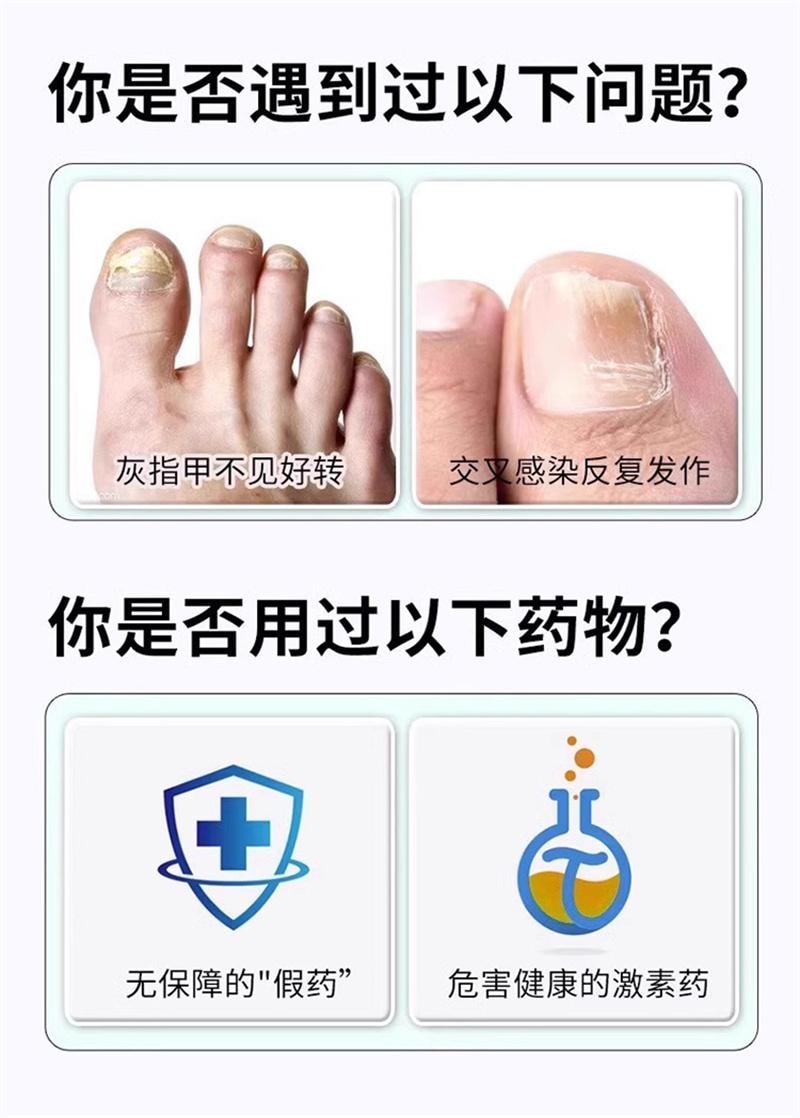  仁和 环吡酮胺乳膏10g灰指甲治疗专用药膏水正品真菌感染脚气药