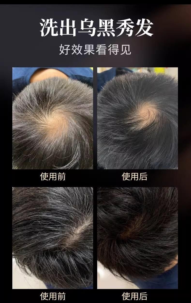 【中国直邮】 南京同仁堂 黑灵芝人参何首乌洗发皂  白发转黑 防脱育发 滋养毛囊 顺滑秀发100g/盒