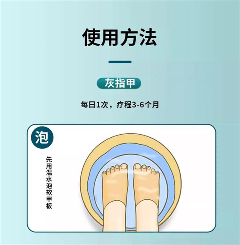 仁和 环吡酮胺乳膏10g灰指甲治疗专用药膏水正品真菌感染脚气药