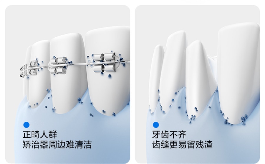 【中国直邮】笑容加USMILE  冲牙器便携式水牙线家用洗牙器牙齿清洁口腔礼物正畸  C10云母白