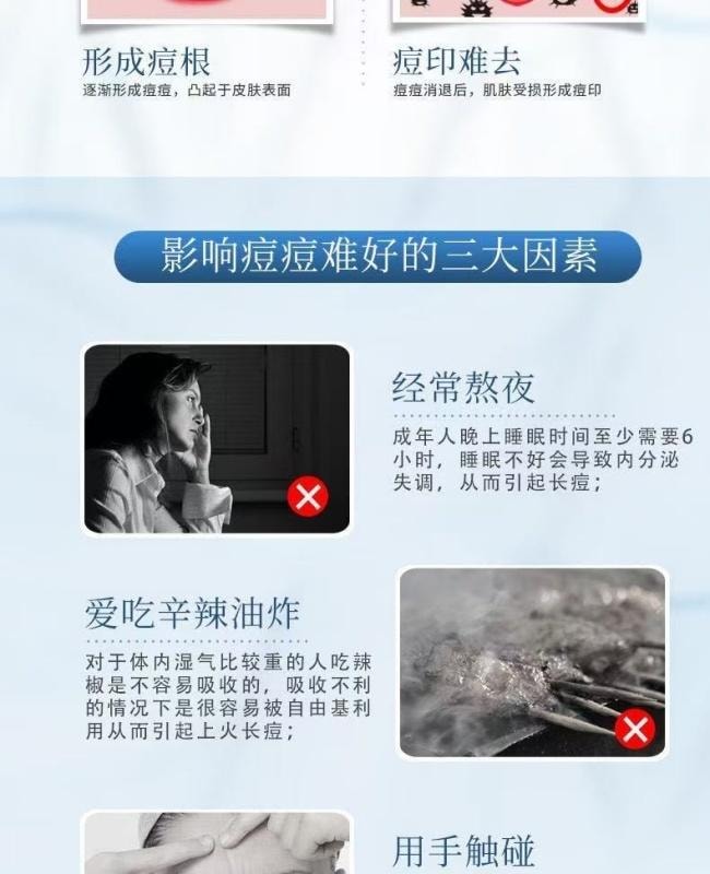 【中國直郵】 白雲山 壬二酸祛痘霜舒緩修復淡化痘印痘疤去黑頭閉口粉刺 祛痘膏25g