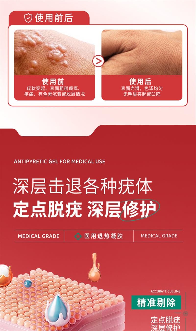 【中国直邮】 北京同仁堂 扁平疣软膏 医用去疣神器去除丝状疣瘊小肉粒一抹灵无忧祛疣型凝胶 20g