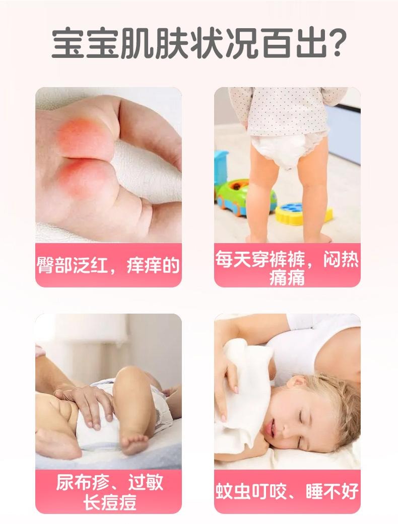 【中国直邮】 欧诺康 炉甘石洗剂洗液儿童皮肤涂剂痱子成人外用止痒粉软膏抑菌   100ml/瓶