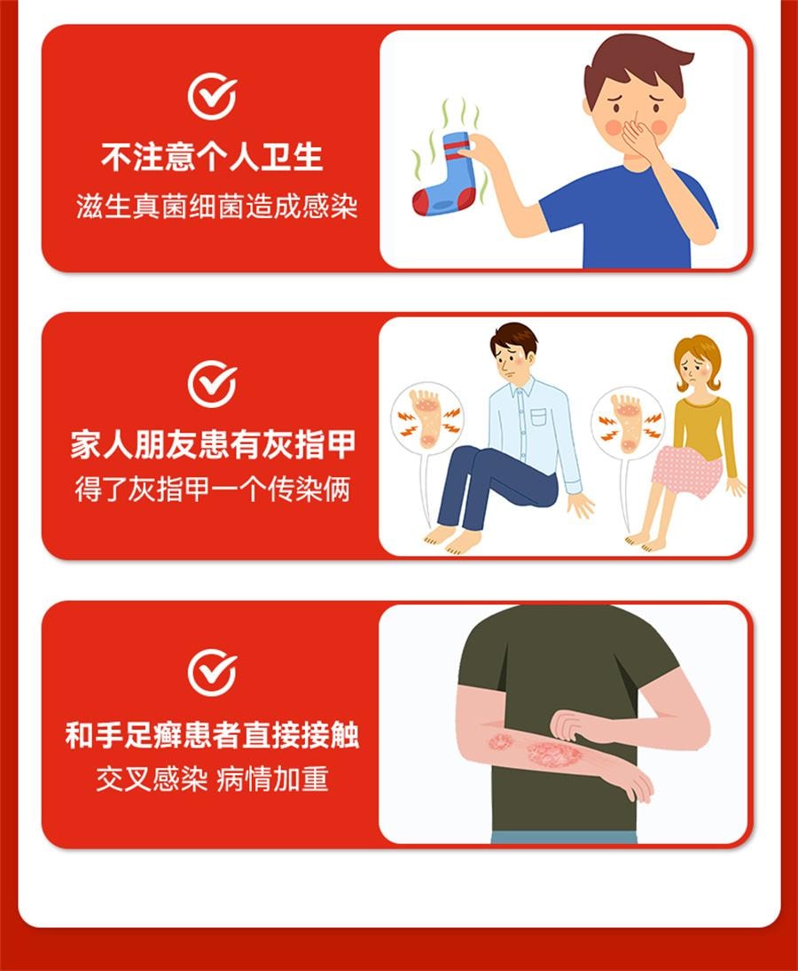 【中国直邮】 太平 硝酸咪康唑乳膏 治疗灰指甲专用药甲硝酸咪康唑乳膏烂脚丫10g/盒