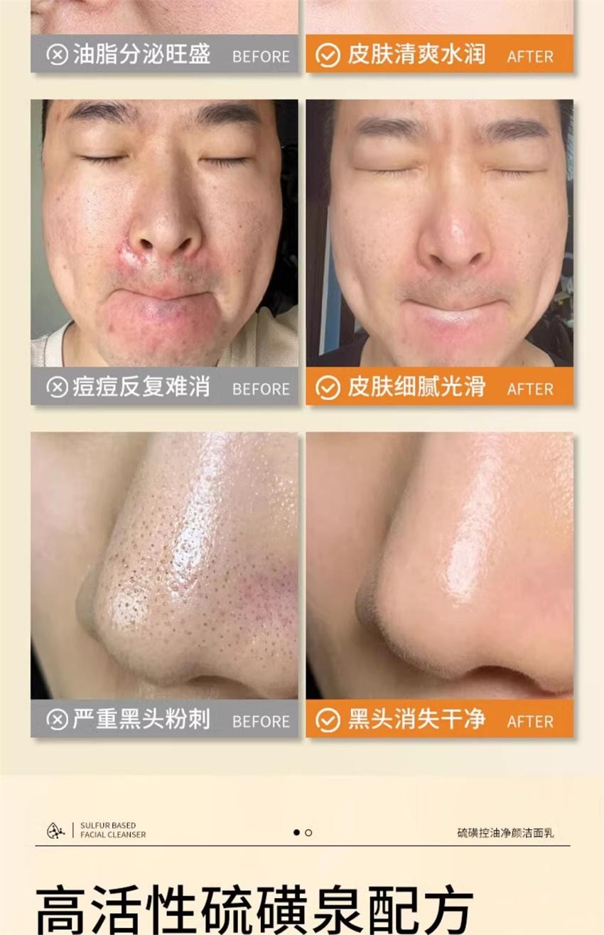 【中國直郵】傾顏 硫磺洗面乳 深層清潔面乳 去蟎收縮毛孔黑頭粉刺控油 100g/支(抖音爆款推薦)