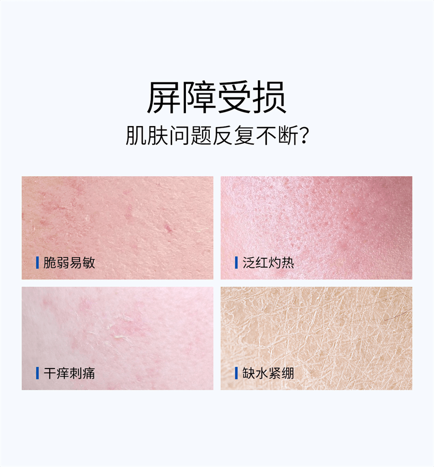 【中國直郵】 ddg 維生素B5煥活保濕修護精華 補水保濕維穩屏障修護舒緩泛紅敏感肌水感 30ml/瓶【清爽版】